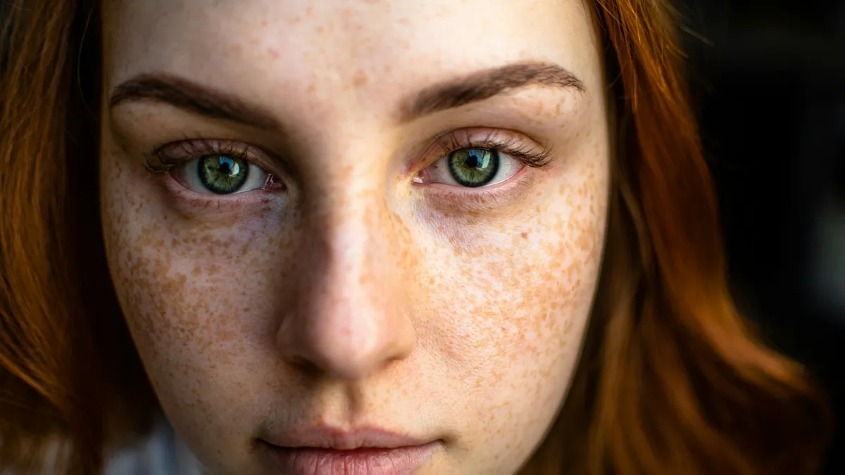 Persoon met roodheid in het gezicht tijdens een huidconsult bij een dermatoloog