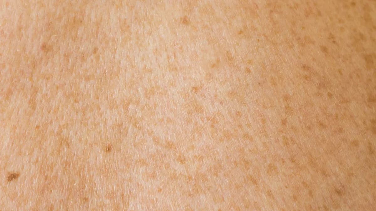 Dermatoloog bekijkt de huid van een patiënt tijdens een consultatie