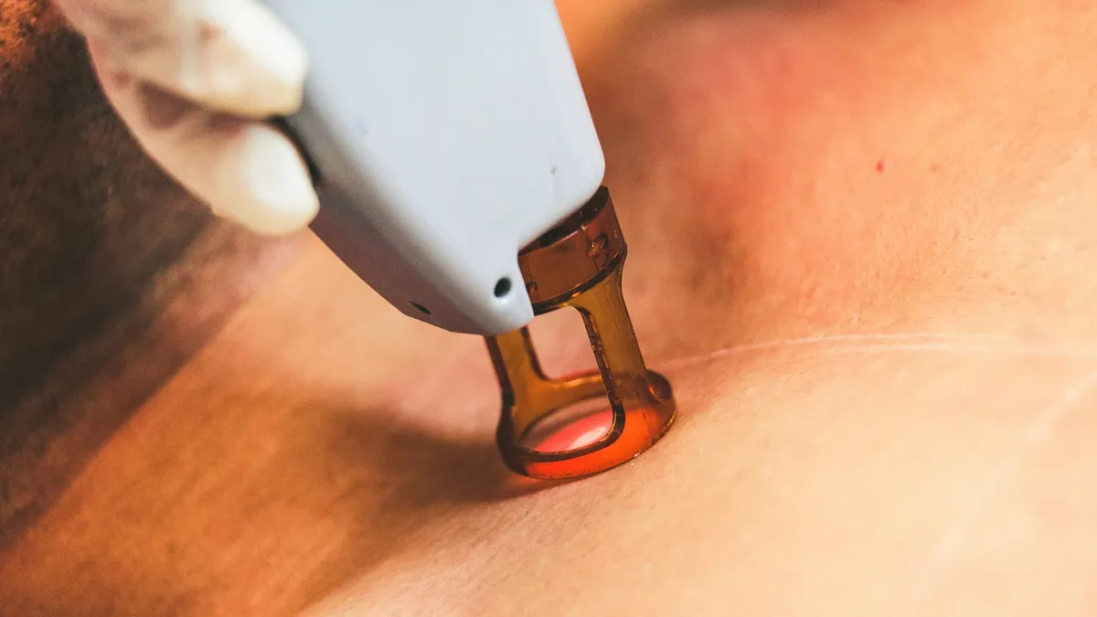 Persoon in gesprek met een huidverzorgingsprofessional tijdens een intake voor een laserbehandeling